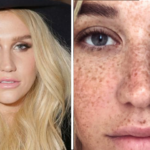 kesha senza trucco_lentiggini